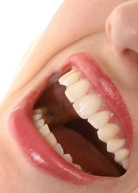 risa un remedio para la salud